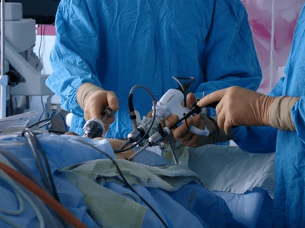 Chirurgický zákrok